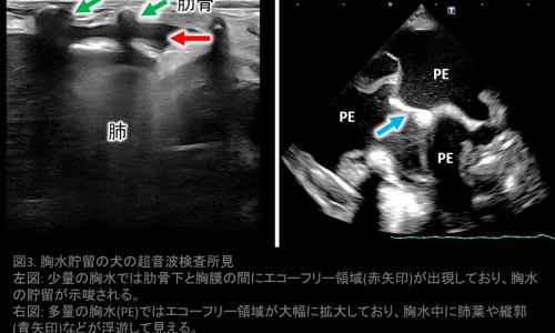子宫内膜息肉症症-子宫内膜息肉的出血特点症状专区_子宫内膜息肉的症状及危害专区_子宫内膜息肉症状有什么网